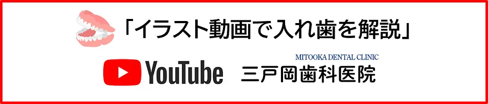 イラスト動画で入れ歯を解説