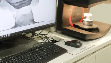 irebascan 入れ歯のスキャン